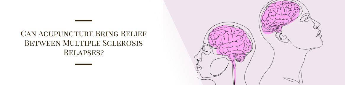 Can Acupuncture Bring Relief Between Multiple Sclerosis Relapses?